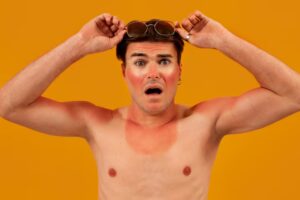 Skin Sun Damage Symptoms