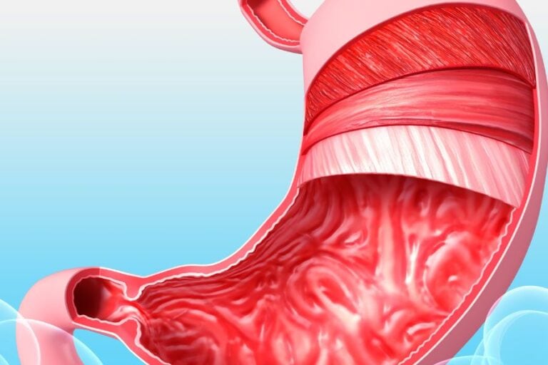 How to Get Rid of Mucus in Stomach: Effective Remedies and Tips