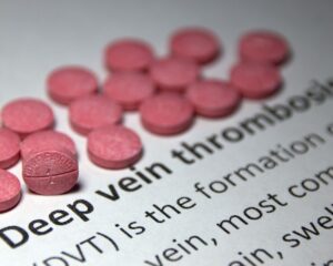 Nonocclusive Thrombus in Deep Vein Thrombosis