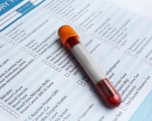 Globulin Blood Test