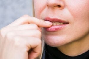 Lip Rash: Causes, Symptoms, and Treatment Options