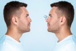 The Ultimate Guide to Different Types of Noses and Their Unique Characteristics