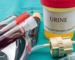 Blood in Urine