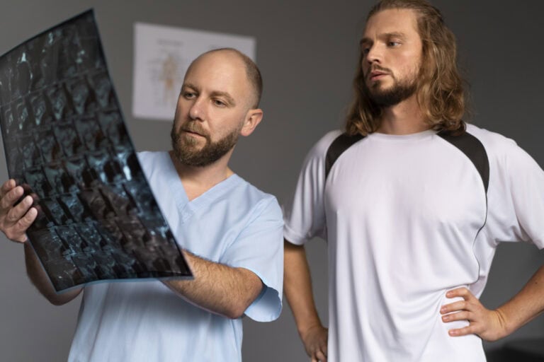 Understanding Todds Paralysis vs Stroke