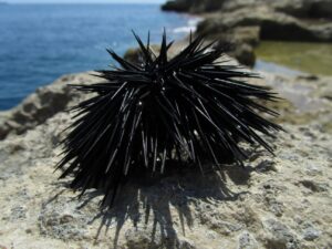 Sea Urchin Stings