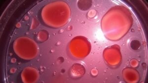 enlarged red blood cells