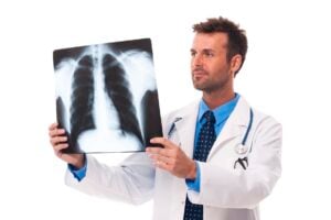 Pleural Effusion