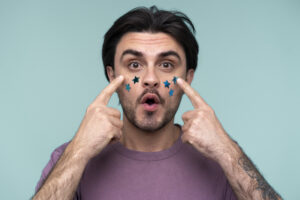 Why Do I Have a Lot of Skin Tags