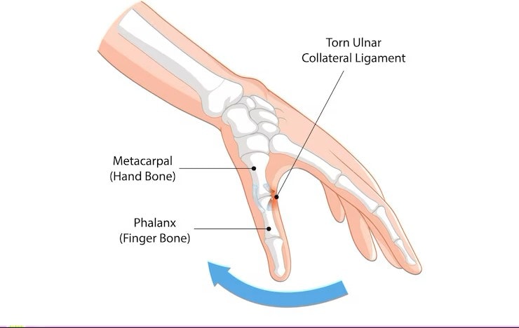 Thumb Anatomy, Diagram & Function: Bones, Muscles, and Mobility 2 Thumb Overview
