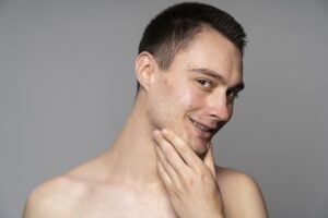 Light Brown Spot in the Skin