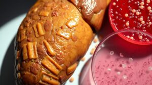 cirrhosis causes low platelets