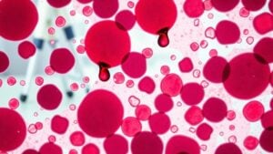 low blood cell levels